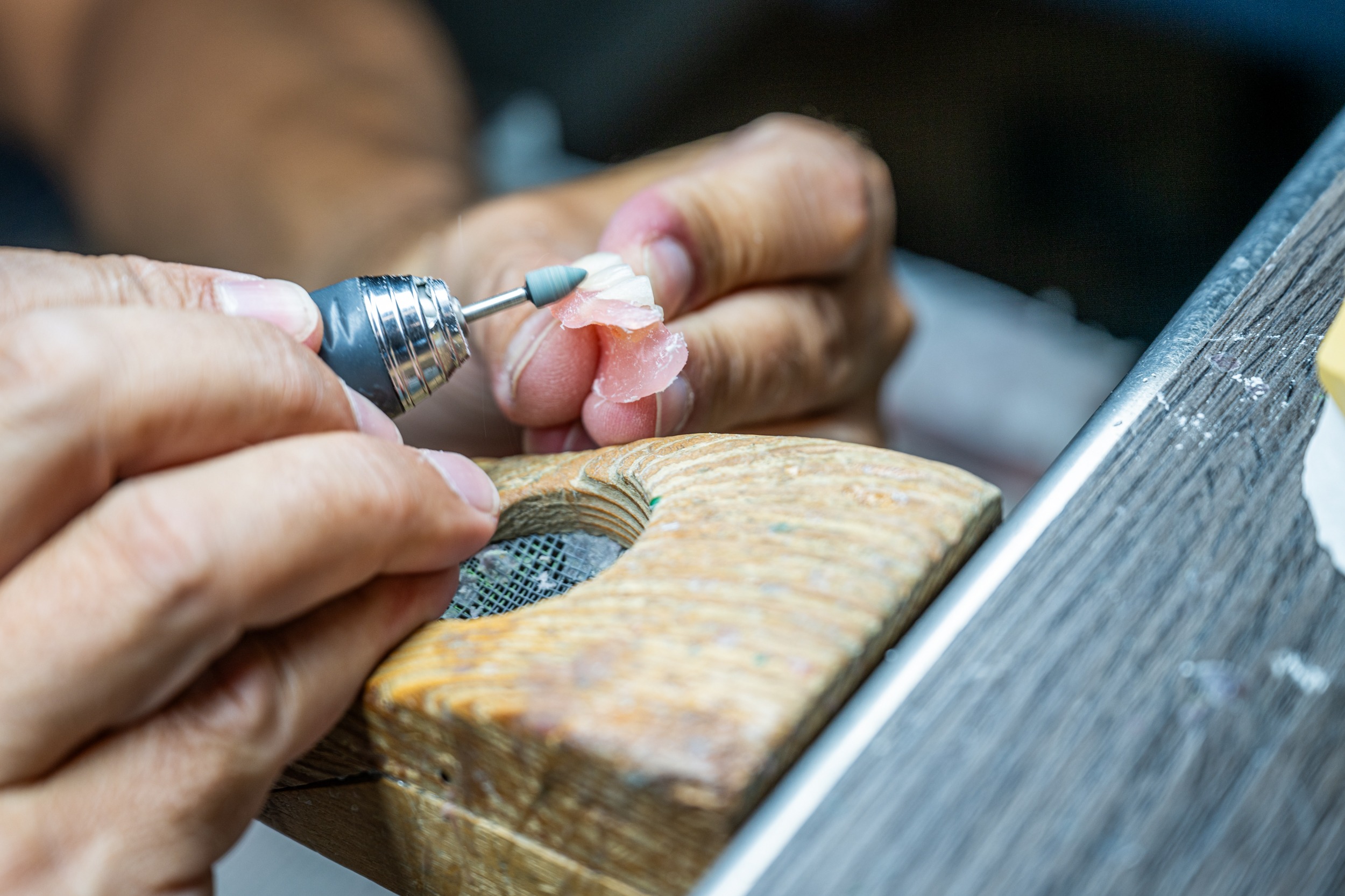 Faccette estetiche dentali Veneers su foglie di platino.